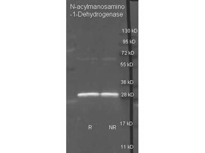 Western Blot: N-acylmannosamine 1-dehydrogenase Antibody [NBP2-44241] - Analysis using the Biotin conjugate of NBP2-44241. Detection of antibody with purified N-acylmanosamino-1-Dehydrogenase under reducing (R) and non-reducing (NR) conditions. Reduced samples of purified target proteins contained 4% BME and were boiled for 5 minutes. Samples of ~1ug of protein per lane were run by SDS-PAGE. Protein was transferred to nitrocellulose and probed with 1:3000 dilution of primary antibody. Detection shown was using Dylight 488 conjugated Donkey anti goat.
